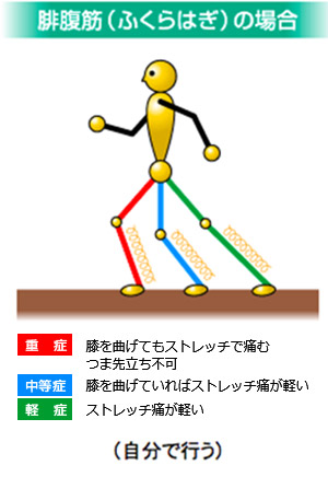 肉離れの診断と治療